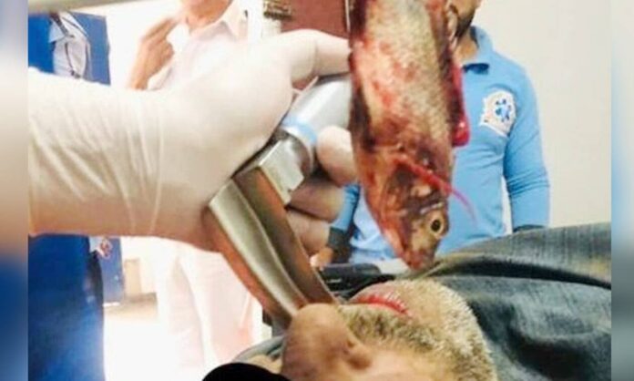 Terrible accident: Live fish stuck in the neck of a fisherman - Harsh images! [VIDEO]